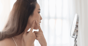 Wellness Balance You Blog Image - Blood Sugar and Acne